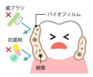 バイオフィルム